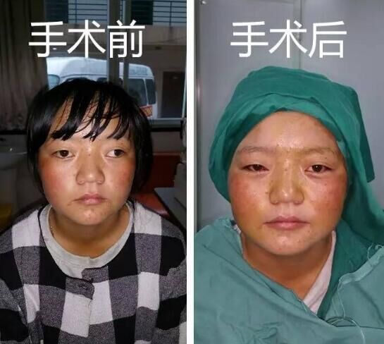 8名西藏眼病兒童完成返藏